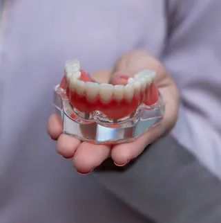 Prótese sobre implante dentário