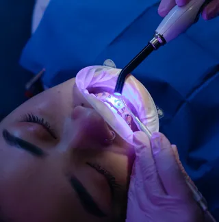 Restauração dentária com luz de polimerização