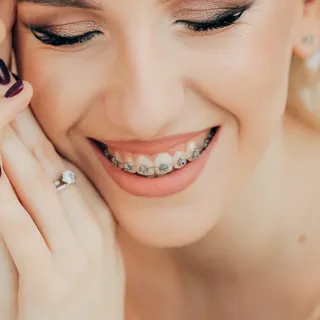 Sorriso com aparelho ortodôntico